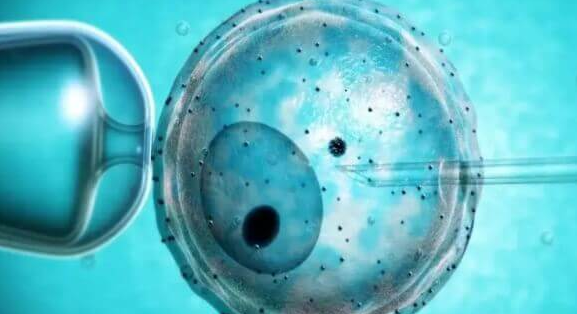 卵巢囊肿能否在美国做试管婴儿？生理性囊肿不影响可直接进行