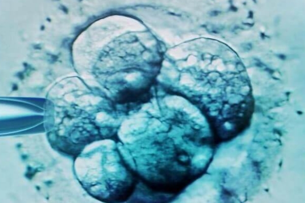美国CCRH生殖中心:胚胎质量欠佳,养囊胜算几何?