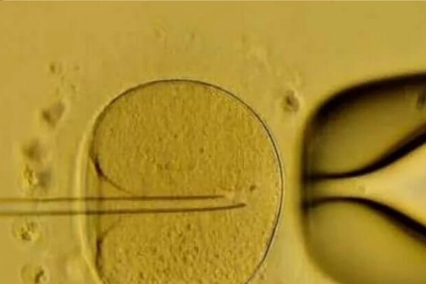 泰国试管胚胎移植成功率：培养时间的长短有影响吗？