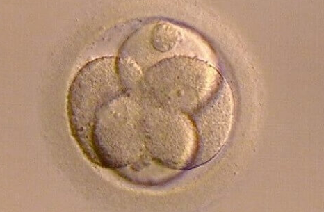 上海试管婴儿医院:试管婴儿养囊失败-胚胎发育与质量为核心因素