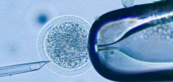 上海试管婴儿医院:试管取卵麻醉选择与术后注意事项全解析