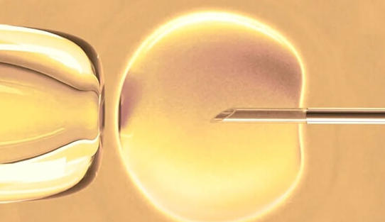 泰国高龄试管婴儿技术：服务完善与高成功率的双重保障