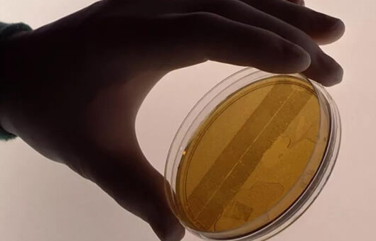 试管婴儿冻胚移植成功率分析:年龄与子宫环境的关键作用