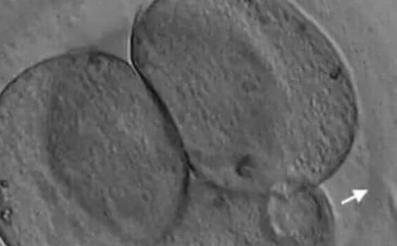 胚胎辅助孵化全解析：高龄女性为何是核心适用人群？