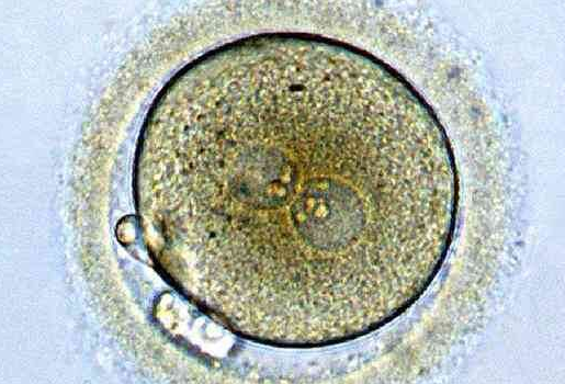 在美国移植冻囊胚不出血是失败了吗？判断标准并不唯一