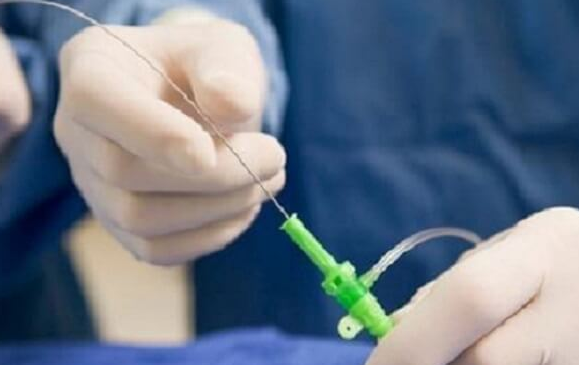 人工授精与试管婴儿：技术复杂度与操作流程对比