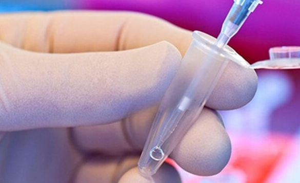 取卵术操作全解析与术前术后注意事项