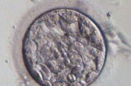 美国试管助孕技术解析：技术优势与适用人群全览