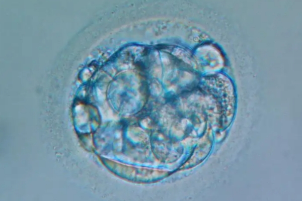 泰国千禧生殖中心:高龄女性试管婴儿成功率挑战-卵巢功能衰退的核心影响