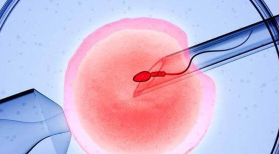 试管取卵后不受精的原因：问题不一定出在卵子上