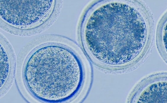 上海试管婴儿医院:试管婴儿促排空卵泡很正常,原因解析与应对策略