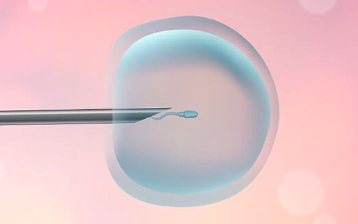 试管婴儿并不是放一男一女！胚胎性别是随机的