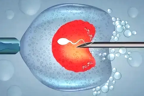 美国试管婴儿降调期间注意事项：保持良好心态至关重要