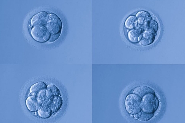 美国EFC生殖中心：冷冻卵子潜在风险及并发症对女性身体健康的影响