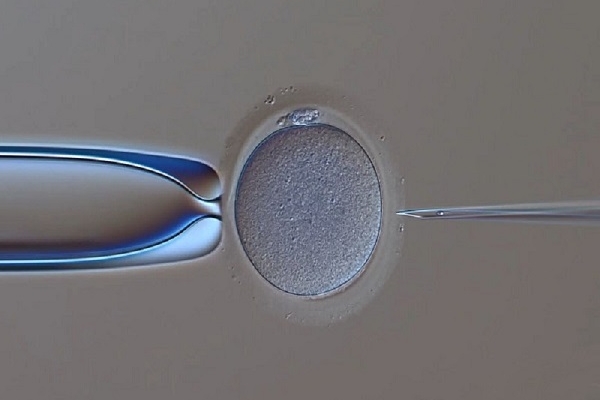 泰国DHC生殖医院：艾灸对胚胎着床的影响及三大注意事项