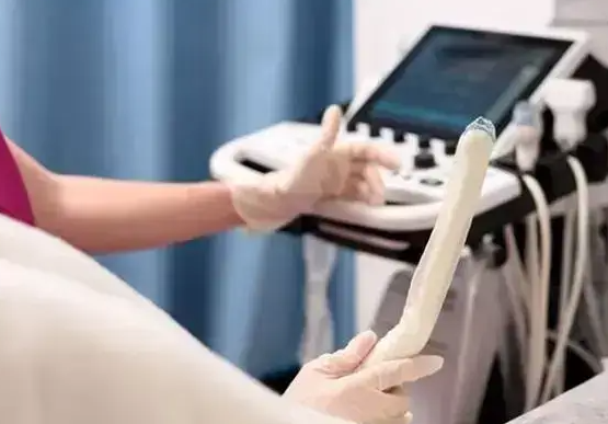 试管婴儿移植前TCT检查：为何不可或缺，不通过为何需暂缓辅助技术