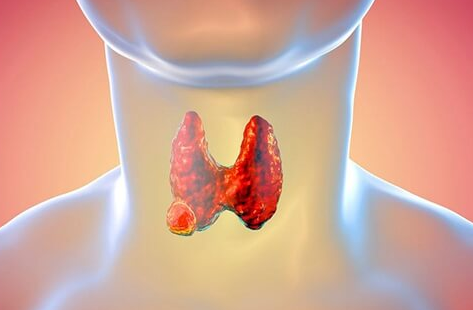 甲状腺结节能否赴美做试管婴儿？良性结节一般影响不大