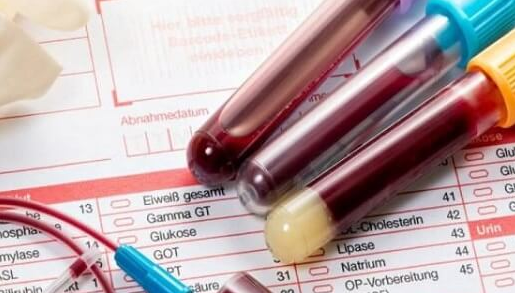 泰国试管移植成功后激素水平变化：孕酮升高是关键着床信号