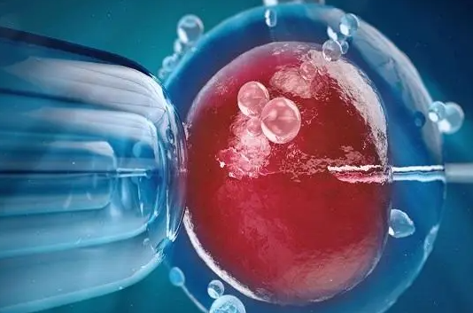 试管婴儿移植18天腰疼的原因解析：是否与宫外孕相关？