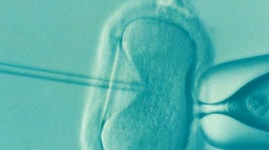 赴美试管：雌激素高对卵泡质量的影响及应对策略