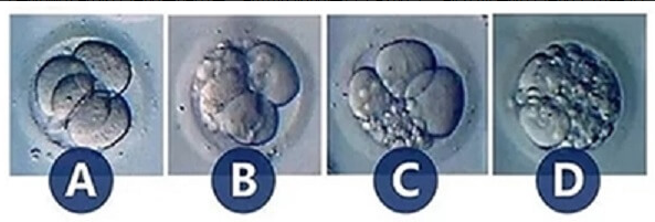 评估胚胎质量的好坏有标准，来看看1 - 4级胚胎怎么分级