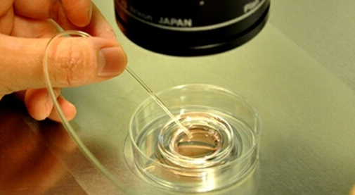 取卵26个能配成多少胚胎？精卵质量是关键