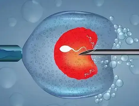 美国供卵试管婴儿成功率解读与费用清单详析