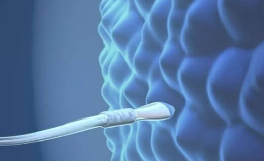 FSH高于20赴美做试管婴儿：受孕难度与卵泡质量挑战