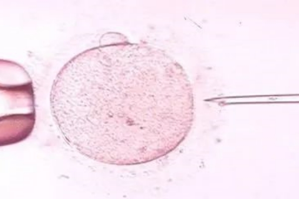 泰国DHC生殖医院：取卵后沐浴指南，热水澡的适宜性与注意事项