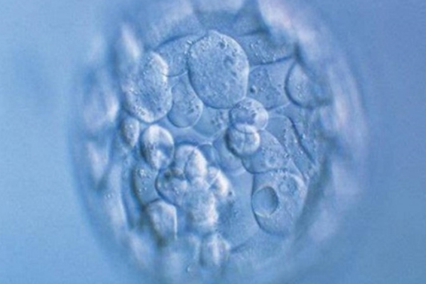 泰国千禧生殖中心：移植一个胚胎也可能变为单卵双胎