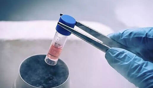 做试管婴儿一定要趁早有原因！影响试管婴儿成功率的因素