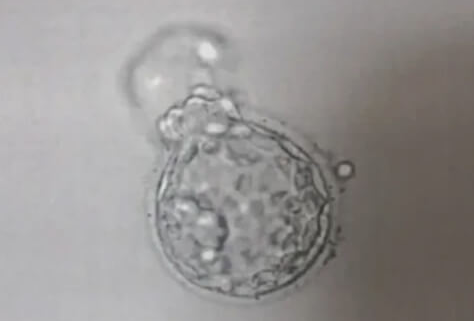 美国鲜胚移植成功率90%？弄清其影响因素就明了