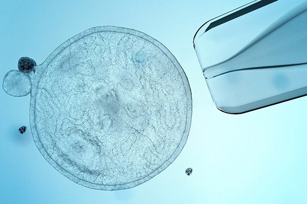 泰国DHC生殖医院：试管进周期后十大禁忌事项，务必牢记