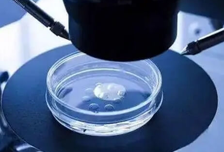 泰国试管：移植胚胎数量与成功率的辩证关系及妊娠风险考量