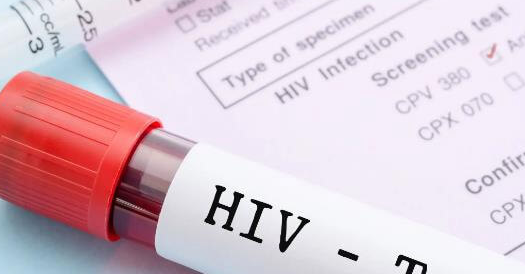 艾滋病患者做试管婴儿须知：病毒载量评估与阻断治疗是关键