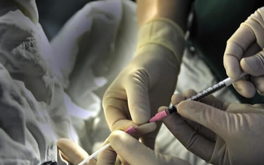 美国试管胚胎移植：复杂流程下的精准操作与时间把控