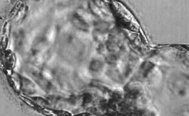 上海试管婴儿医院：养囊成功率取决于精子还是卵子？