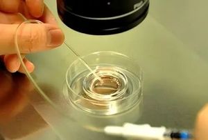 试管促排取卵少？这些关键因素和细节你知道吗？