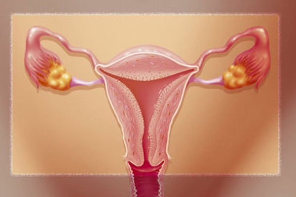 美国EFC生殖中心：孕前检查发现子宫肌瘤如何避免不孕风险