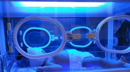 泰国做试管婴儿会容易得黄疸？或与激素药物有关