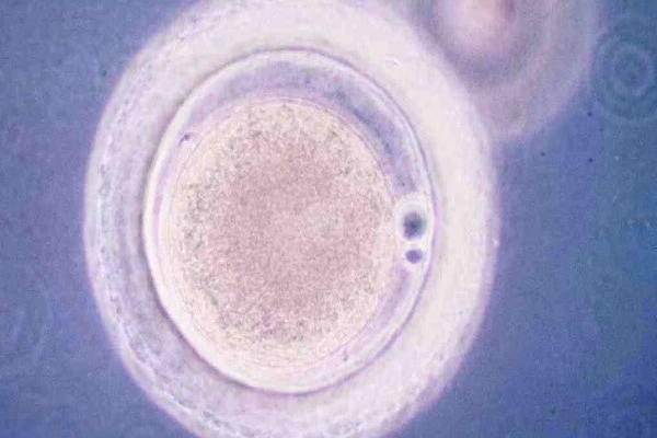 泰国DHC生殖医院：影响囊胚活检率的因素-胚胎质量与数量成关键
