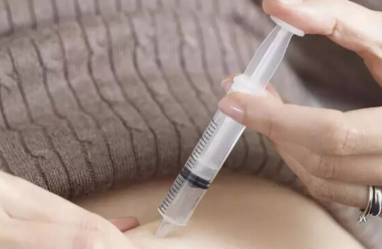 试管婴儿微刺激方案:以温和之力提升卵子质量