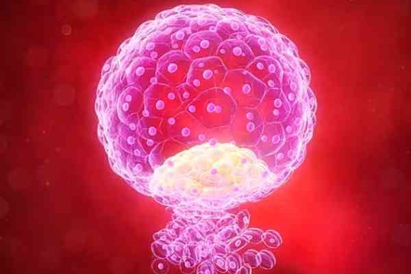 美国EFC生殖中心：囊胚移植生化妊娠的原因