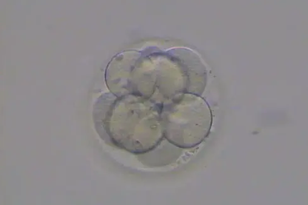 美国EFC生殖中心：试管婴儿囊胚培养失败-胚胎发育异常是关键