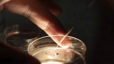 赴美做试管要注意哪些问题