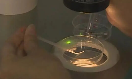 到泰国做试管婴儿取卵和取精必须同一天吗？