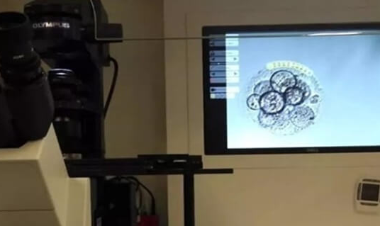 取卵10个能养囊几个，胚胎发育潜力高的可养6个