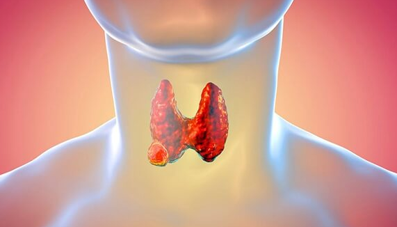 甲状腺结节能否到美国做试管婴儿？需视情况而定