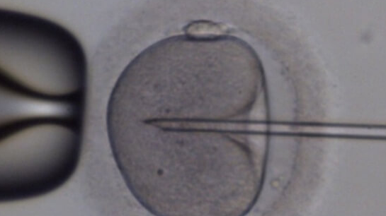 上海试管婴儿医院：促排卵泡质量不好或与卵巢储备下降有关