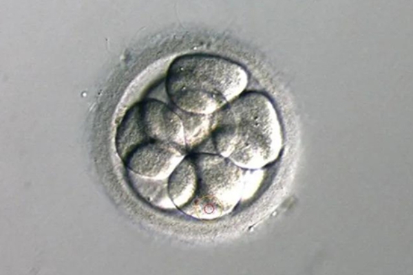 泰国千禧生殖中心：试管婴儿胚胎存活率挑战-多重因素深入剖析